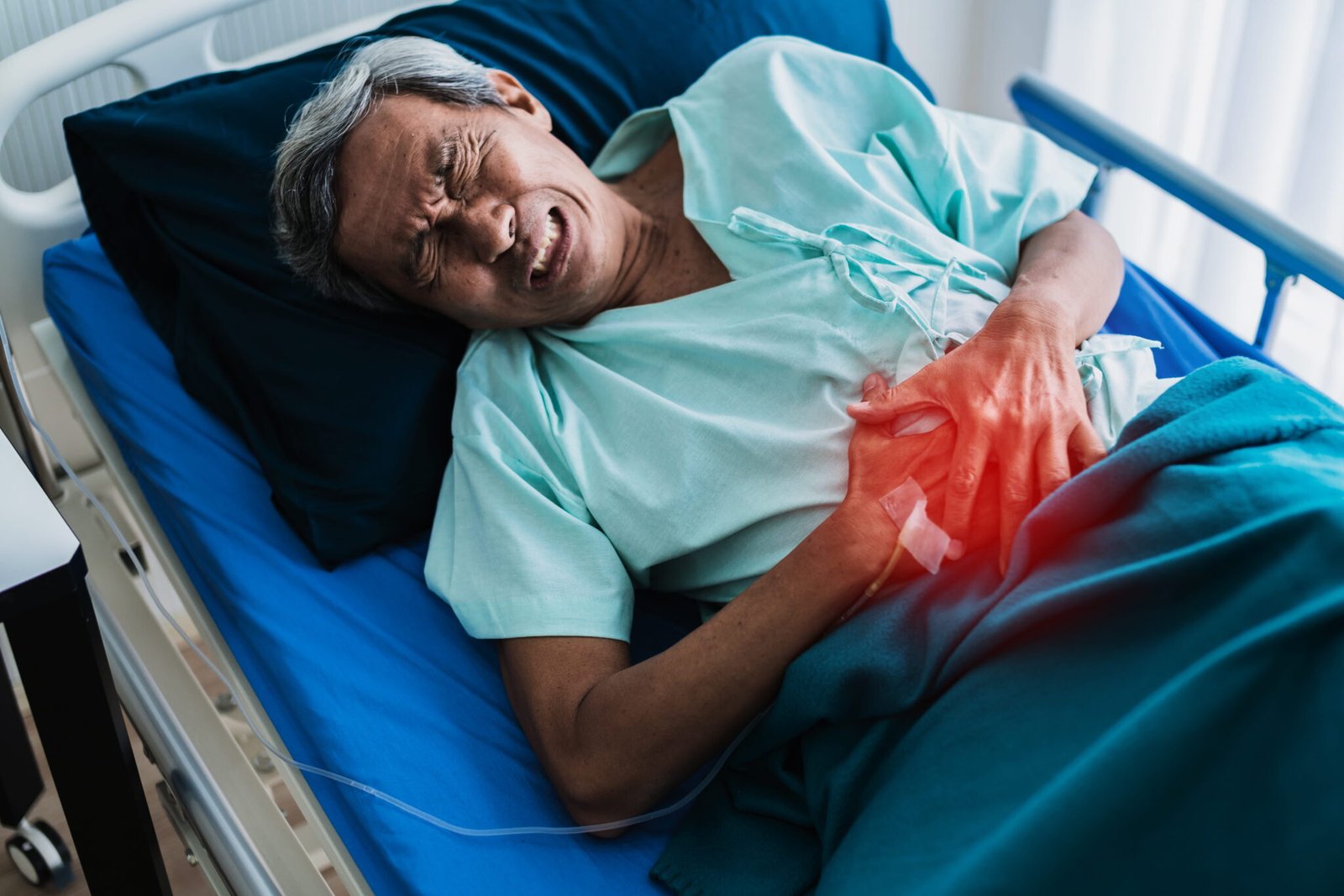Acute Kidney Injury (AKI)